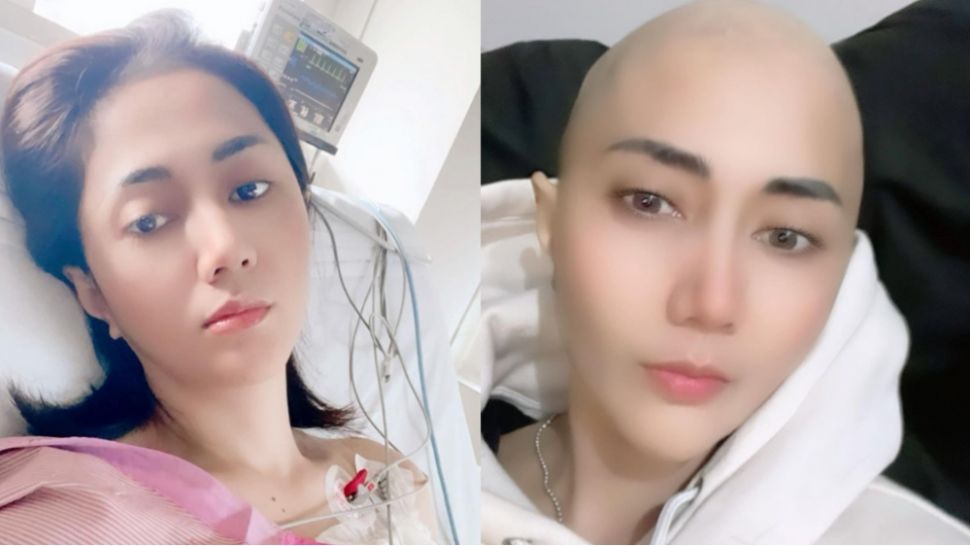 Kondisi Aida Saskia Yang Tengah Melawan Kanker Payudara (Instagram/@aidasaskia.new)