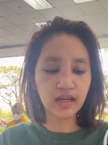 Potret hidung Permesta Dhyaz bengkak usai operasi [Instagram/@permestadhyaz]