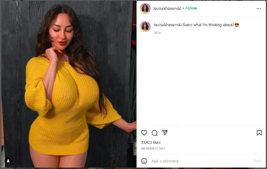 Curhat Wanita Punya Ukuran Dada 30HH, Susah Cari Pekerjaan (instagram.com/louisakhovanski)