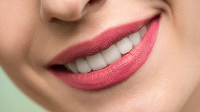 ilustrasi gigi bersih dan putih (Pexels.com)