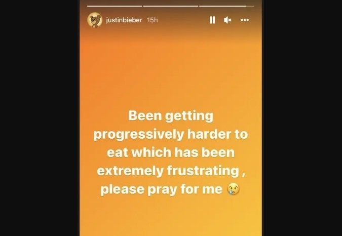 Justin Bieber frustasi karena tidak bisa makan (Instagram)