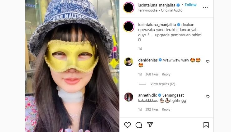 Wajah baru Lucinta Luna selepas operasi plastik. (Instagram/@lucintaluna_manjalita)