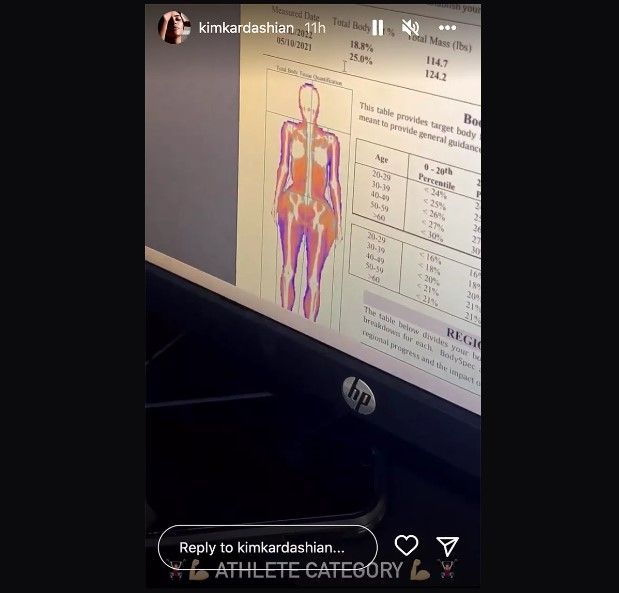 Hasil pemindaian Kim Kardashian (Instagram)
