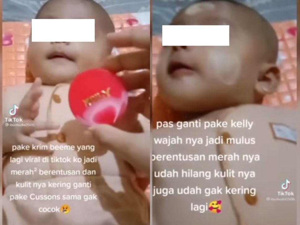 Klaim Bikin Mulus dan Tak Beruntusan, Video Ibu Oleskan Krim Kelly ke Wajah Bayi Tuai Kecaman Publik