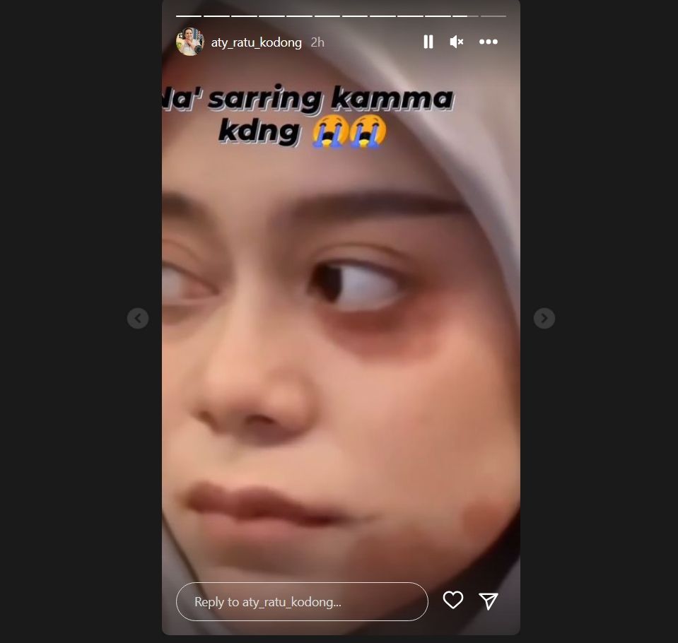 Instagram Aty Kodong unggah foto diduga Lesti dengan wajah memar. (dok. Instagram)