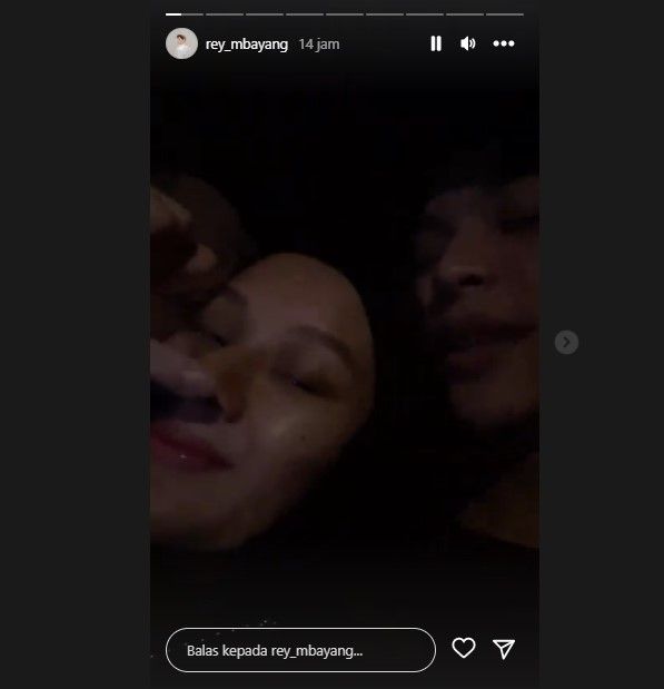 Hidung Dinda Hauw diduga operasi (Instagram)