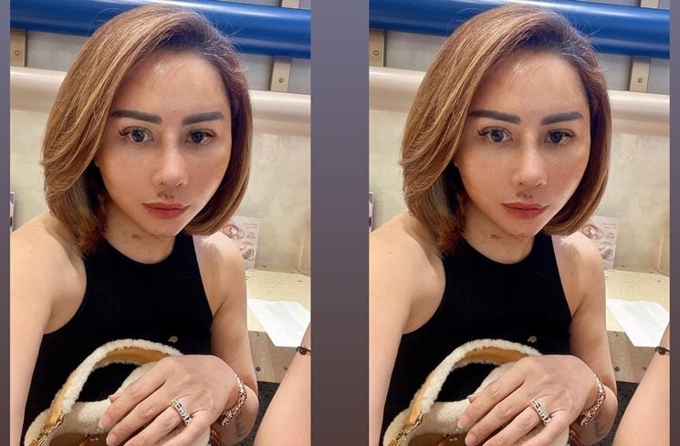 Potret Wajah Femmy Permatasari usai Oplas di Korea (Instagram/@femmypermatasari)