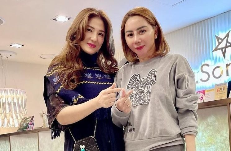 Potret Wajah Femmy Permatasari usai Oplas di Korea (Instagram/@femmypermatasari)