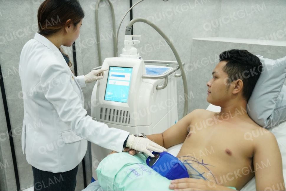 Coolsculpting, Perawatan Untuk Hilangkan Lemak (Dok Quickglam)