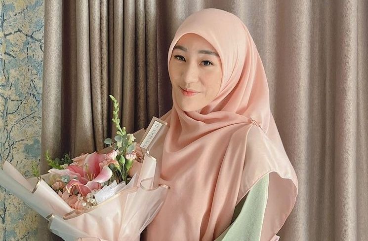 Potret Terkini Larissa Chou (Instagram/@larissachou)