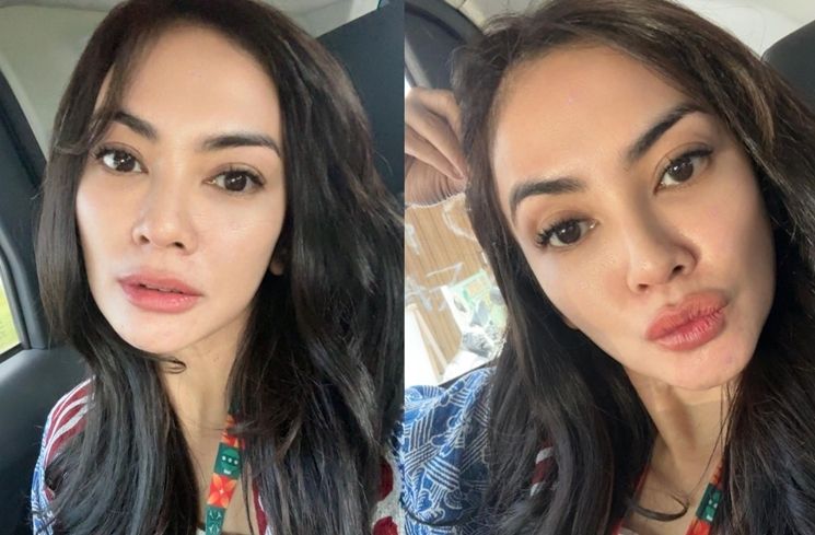 Potret Masayu Anastasia yang Sering Disebut Oplas. (Instagram/@masayuanastasia)