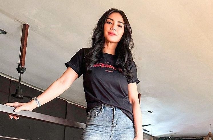 Potret Masayu Anastasia yang Sering Disebut Oplas. (Instagram/@masayuanastasia)