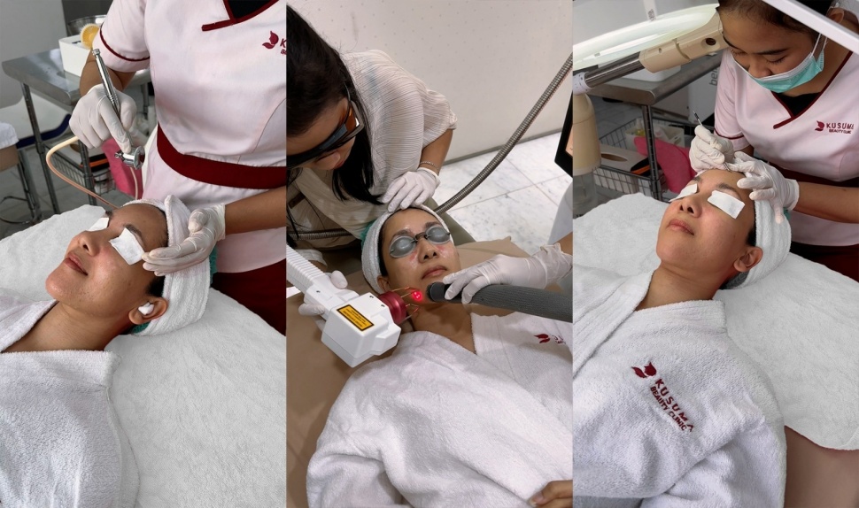 Ilustrasi: Facial Oxy Laser. (Kusuma Beauty Clinic)