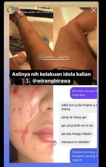 Postingan istri Wirang Birawa, Umi Kalsum [Instagram]