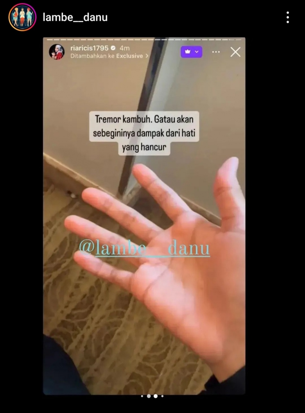 Ria Ricis sebut tangan tremor kambuh. (Dok. Instagram)