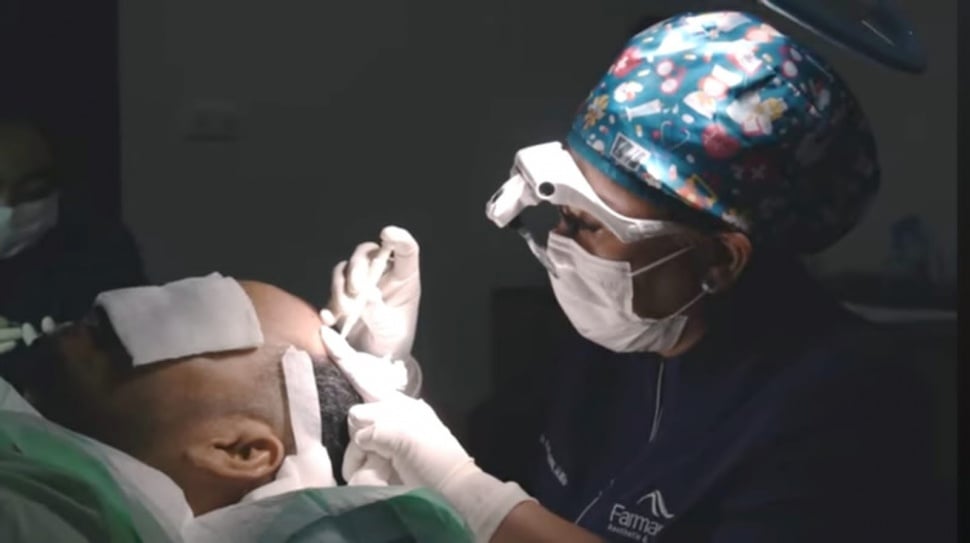 Transplantasi Rambut di Farmanina Clinic yang Cocok Untuk Wisata Medis di Bali (Dok. Istimewa)