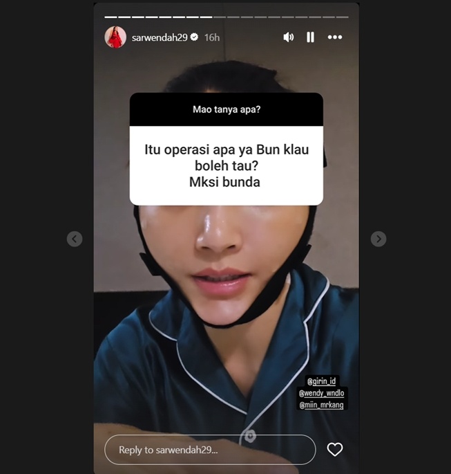 Sarwendah operasi di bagian bawah mata (Instagram)