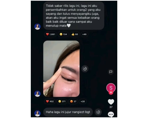 Mahalini diduga operasi kelopak mata (Instagram)