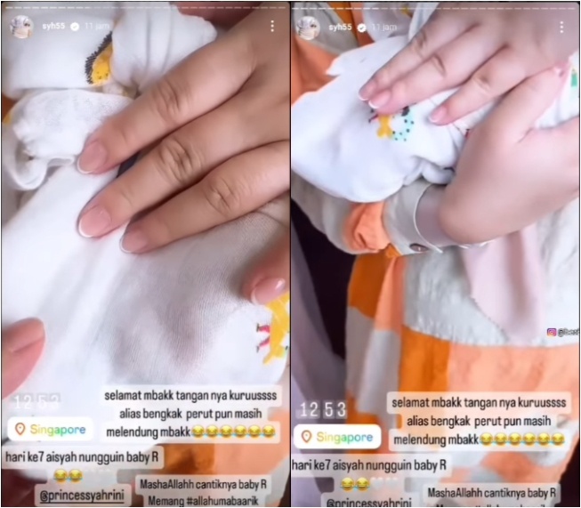 Tangan bengkak Syahrini (Instagram)