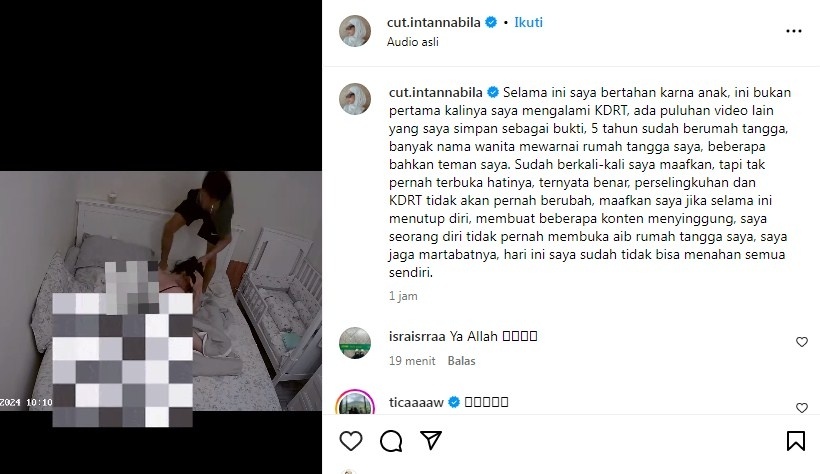 Cut Intan Nabila dianiaya suami sendiri [Instagram/@cut.intannabila]