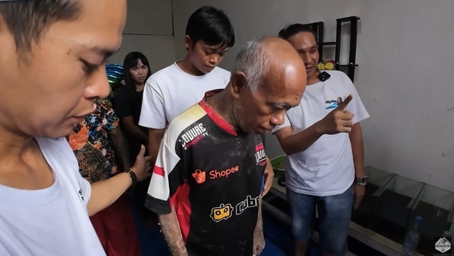 Pak Tarno dapat berjalan usai diterapi (YouTube)