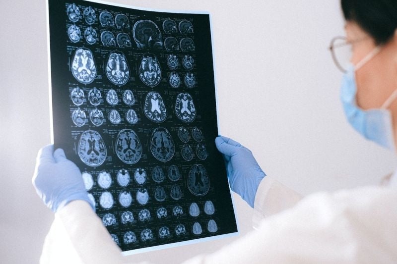 Ilustrasi dokter menganalisa penyakit stroke. [Pexels]