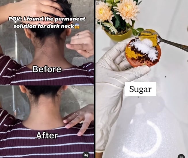 Scrub tengkuk gelap menggunakan bahan dapur yang mudah ditemukan di rumah (Instagram)