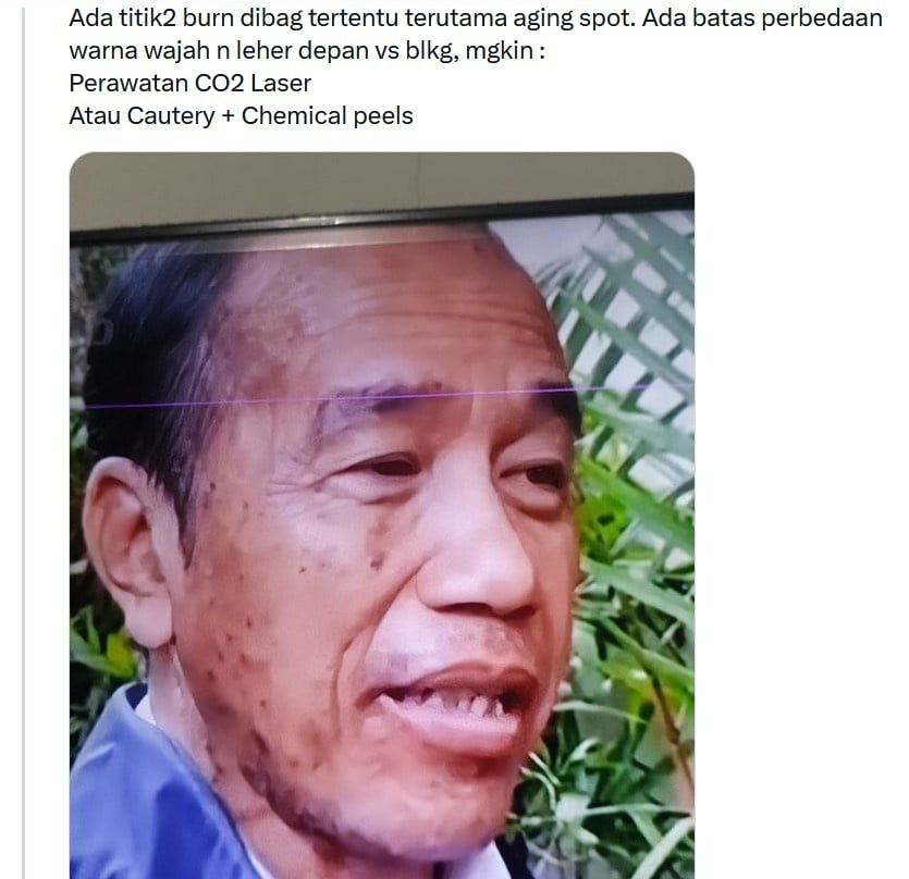 Seorang warganet di X mengomentari wajah mantan presiden Jokowi yang nampak kusam dan terdapat sejumlah warna gelap. [Twitter/X]