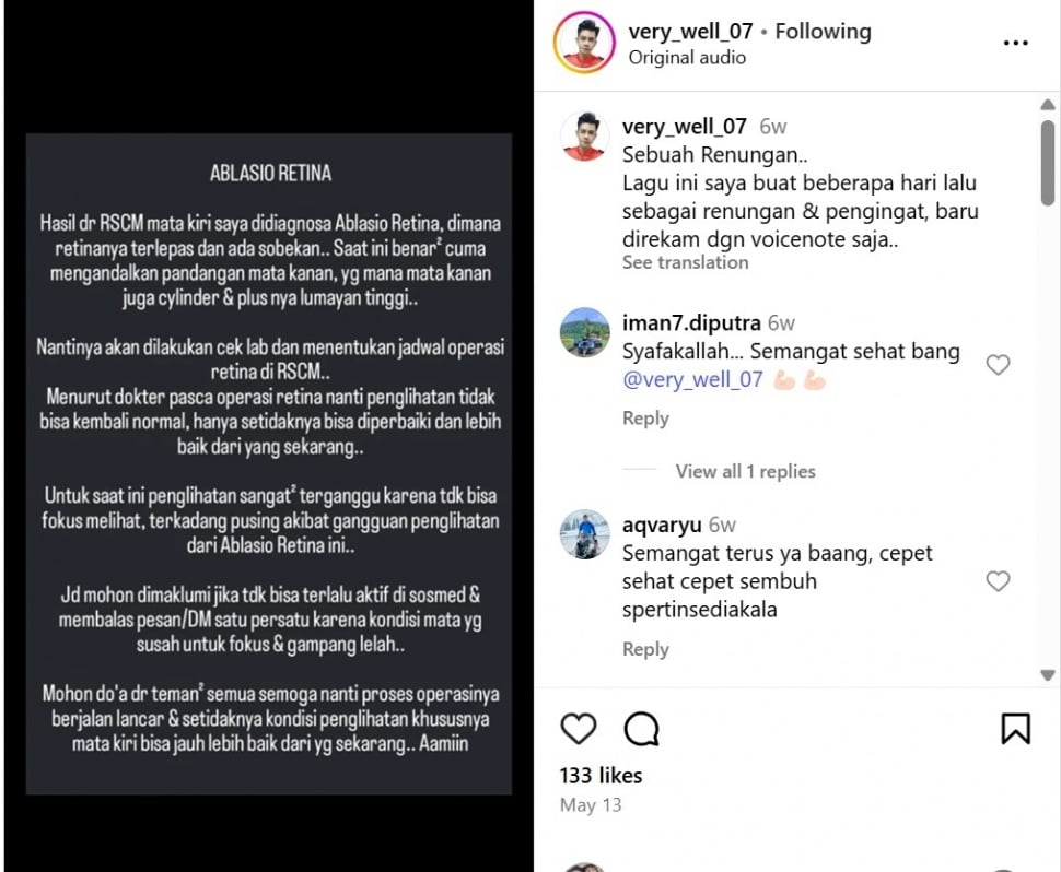 Veri AFI mengungkap kondisi mata kirinya yang mengalami ablasio retina. [Instagram]