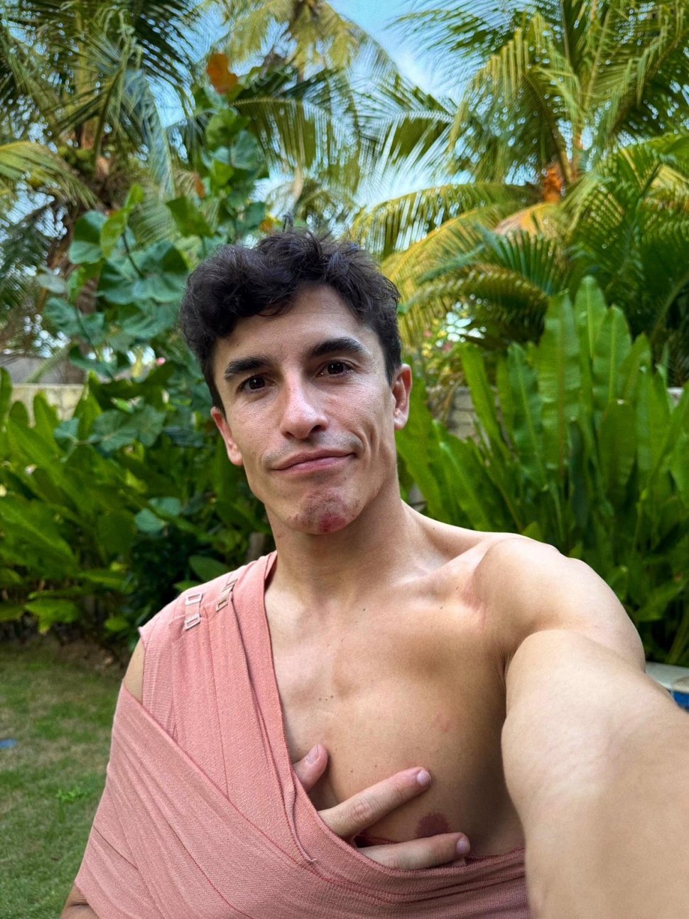 Kondisi Terbaru Marc Marquez Usai Patah Tulang Bahu Kanan di MotoGP Mandalika [@marcmarquez93]