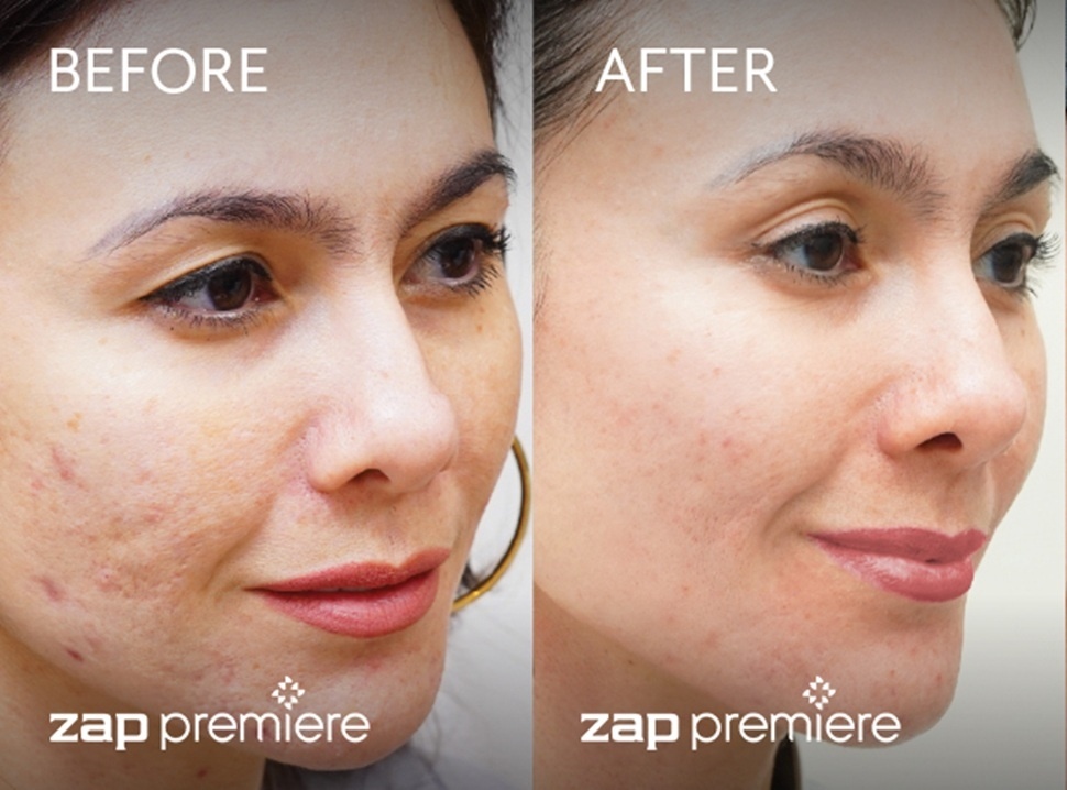 Wulan Guritno bare face (ZAP Premiere)