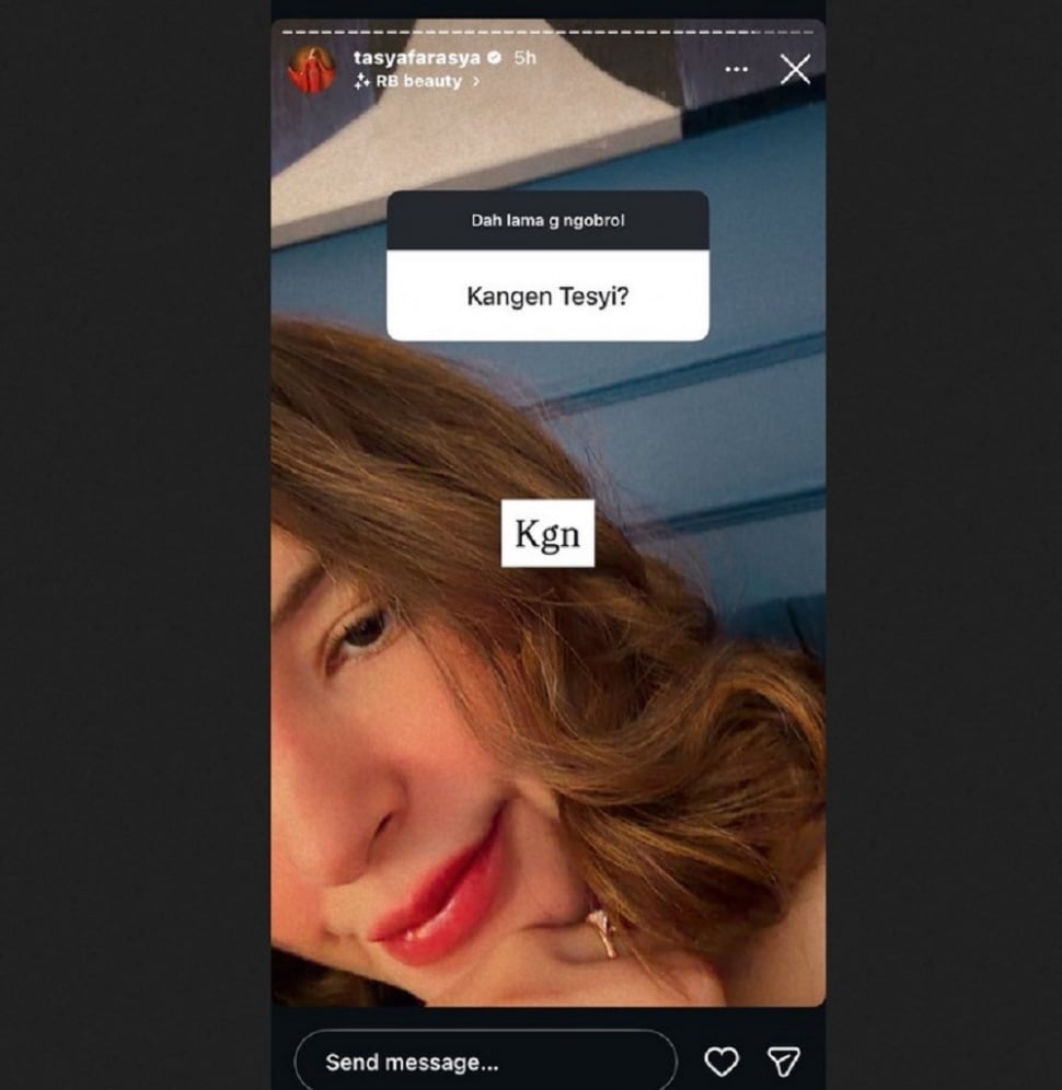Tasya Farsya mengaku kangen dengan kembarannya, Tasyi Athasyia. [Instagram]