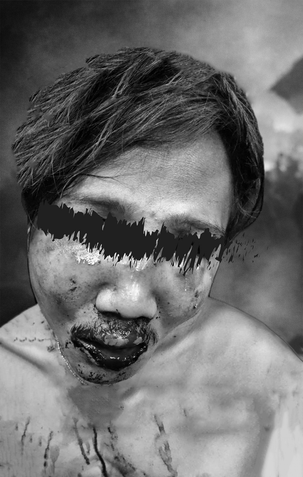 Foto salah satu korban penganiayaan dalam Polres Jakarta Utara.&nbsp;[dokumentasi]