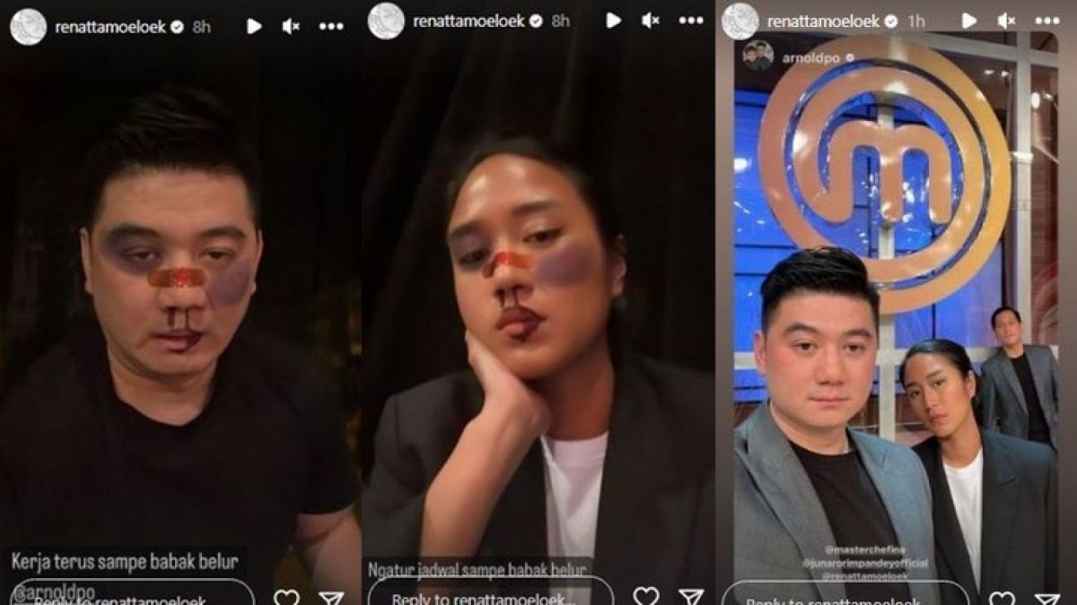 Chef renata babak belur