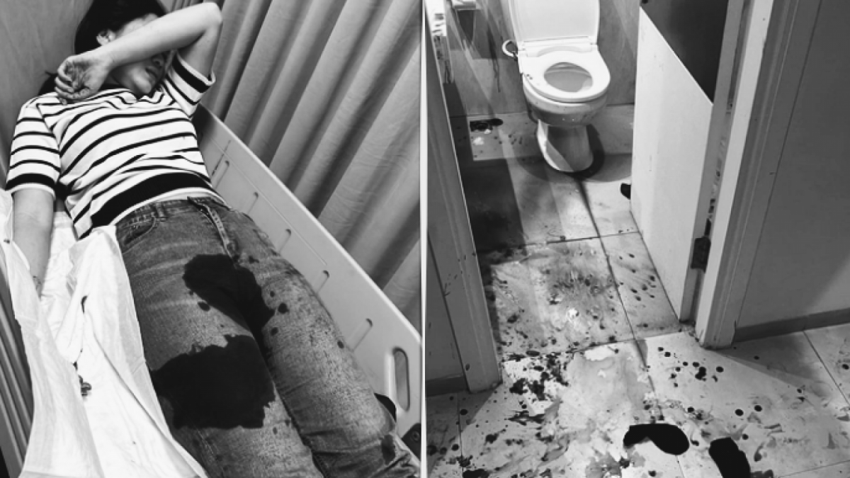 Wanita di Bandung alami kejadian naas oleh mantan pacarnya hingga bersimbah darah [Instagram/ @sarahkeihl]