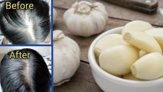 Kerap Alami Rambut Rontok? Cepat Atasi Cukup Gunakan Bahan Alami Ini, Begini Penjelasannya