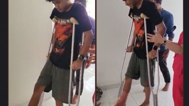 Keseimbangan Tubuh David Ozora Belum Stabil, Pergelangan Kaki Retak dan Harus Dioperasi Karena Terjatuh