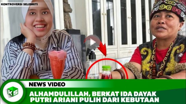Putri Ariani Sembuh dari Kebutaan Berkat Ibu Ida Dayak, Apakah Benar? Simak CEK FAKTA Berikut Ini