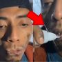 Berakhir Pilu, Begini Nasib Pria Madura yang Nekat Oleskan Lem China pada Bibirnya