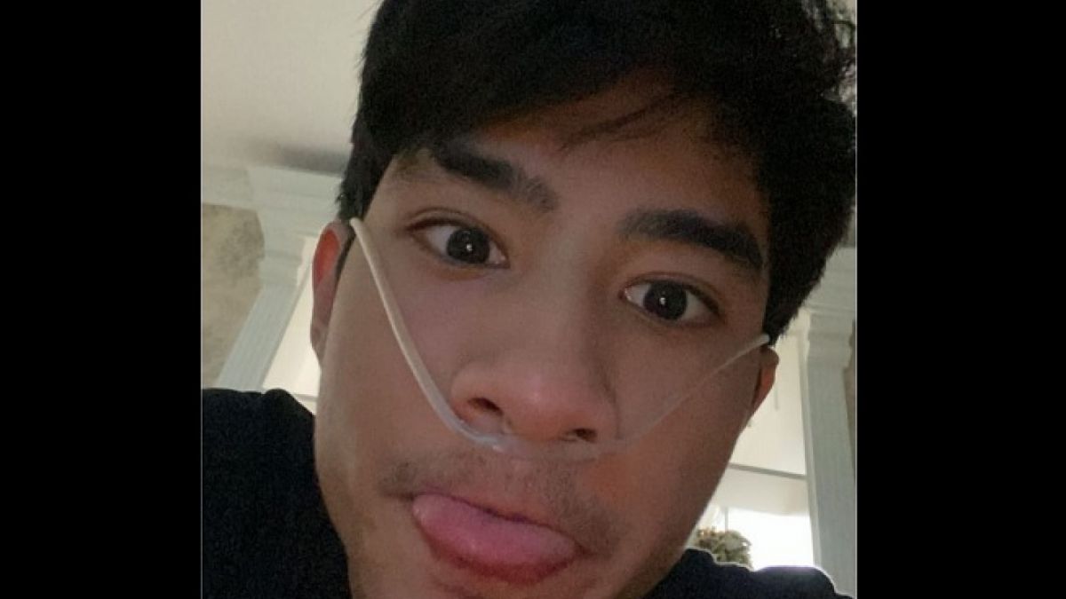 Devano Danendra tampil selfie dengan selang oksigen terpasang di hidungnya sembari curhat pilu. [Instagram @iamdevano]