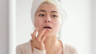 Kurang Percaya Diri Karena Bibir Pecah-Pecah? Terapkan 3 Tips Mudah Atasi Bibir Pecah-Pecah!