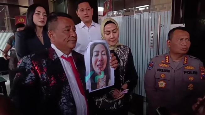 Hotman Paris Sebut Venna Melinda Alami KDRT Sejak Tiga Bulan Lalu