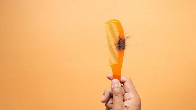 Bisa Botak Jika Dibiarkan, Ini Cara Alami Mengatasi Rambut Rontok