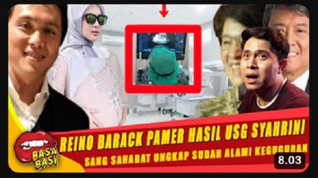 Cek Fakta, Syahrini Keguguran hingga Depresi, Chakra Khan Bongkar Semua saat Reino Barack Pamer Hasil USG Istrinya