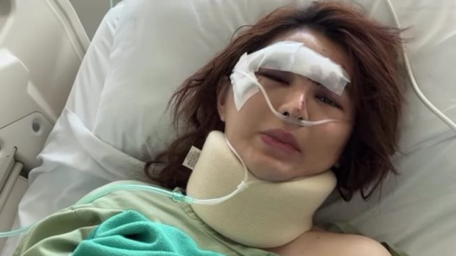 Angela Lee Kecelakaan Mobil, Bikin Sayembara untuk Temukan Barang Penting Ini: Lokasi Udah Dilacak Ada di...