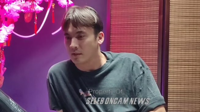 Bukan Tato Syahnaz! Rendy Kjaernett Tunjukan Gambar Ini di Tubuhnya, Ternyata...