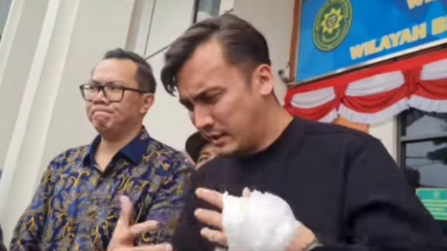 Rendy Kjaernett Merasa Tidak Pantas Dapat Pertolongan Tuhan Saat Alami Kecelakaan Bersama Lady Nayoan