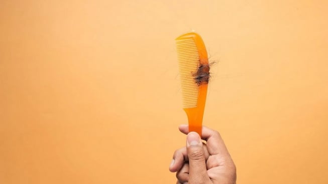 Tidak Perlu Beli Produk Mahal, Ini Cara Alami Mengatasi rambut Rontok, Salah Satunya Tentang Cara Potong