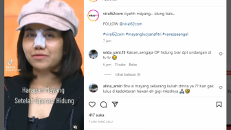 Operasi Hidung, Mayang Dicibir: Biar Dapat Undangan di TV