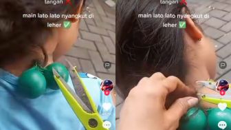 Mulai Meresahkan, Tak hanya bikin Lebam, Lato-Lato Cewek ini Nyangkut di Leher